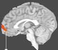 Medial prefrontal cortex.jpg